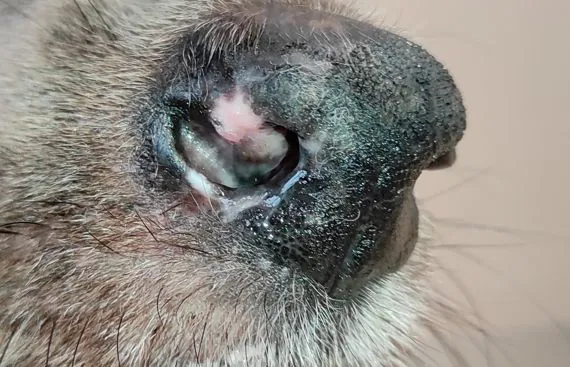 Dermatite sterile del tartufo