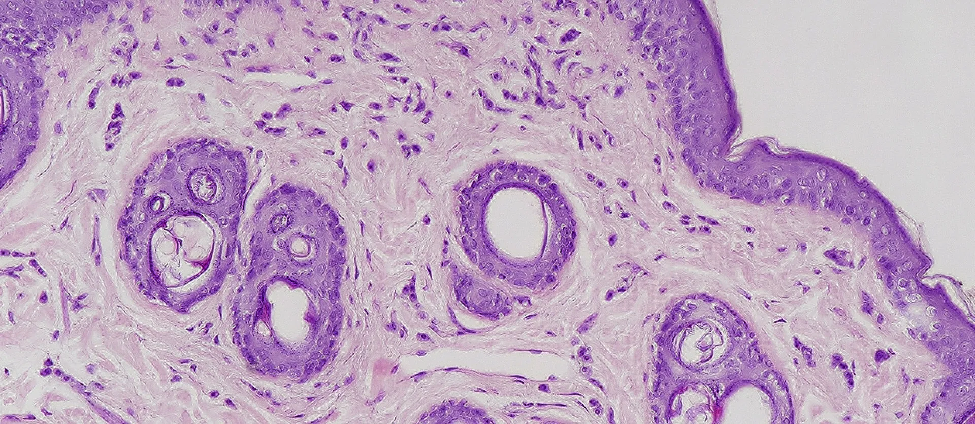 Urticaria Pigmentosa Sphynx