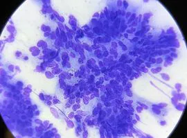 Esami Citologici Cutanei