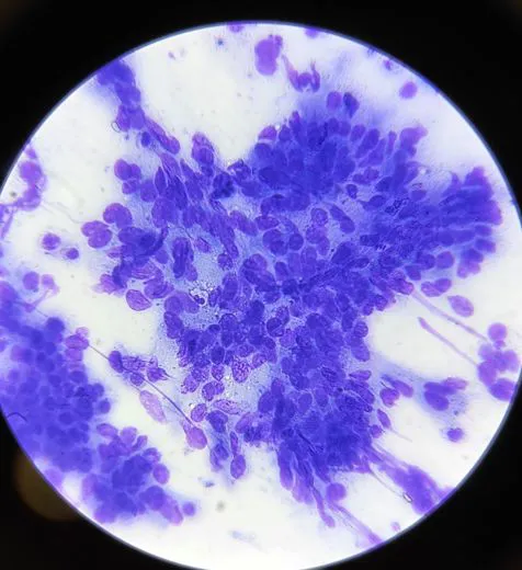 Esami Citologici Cutanei